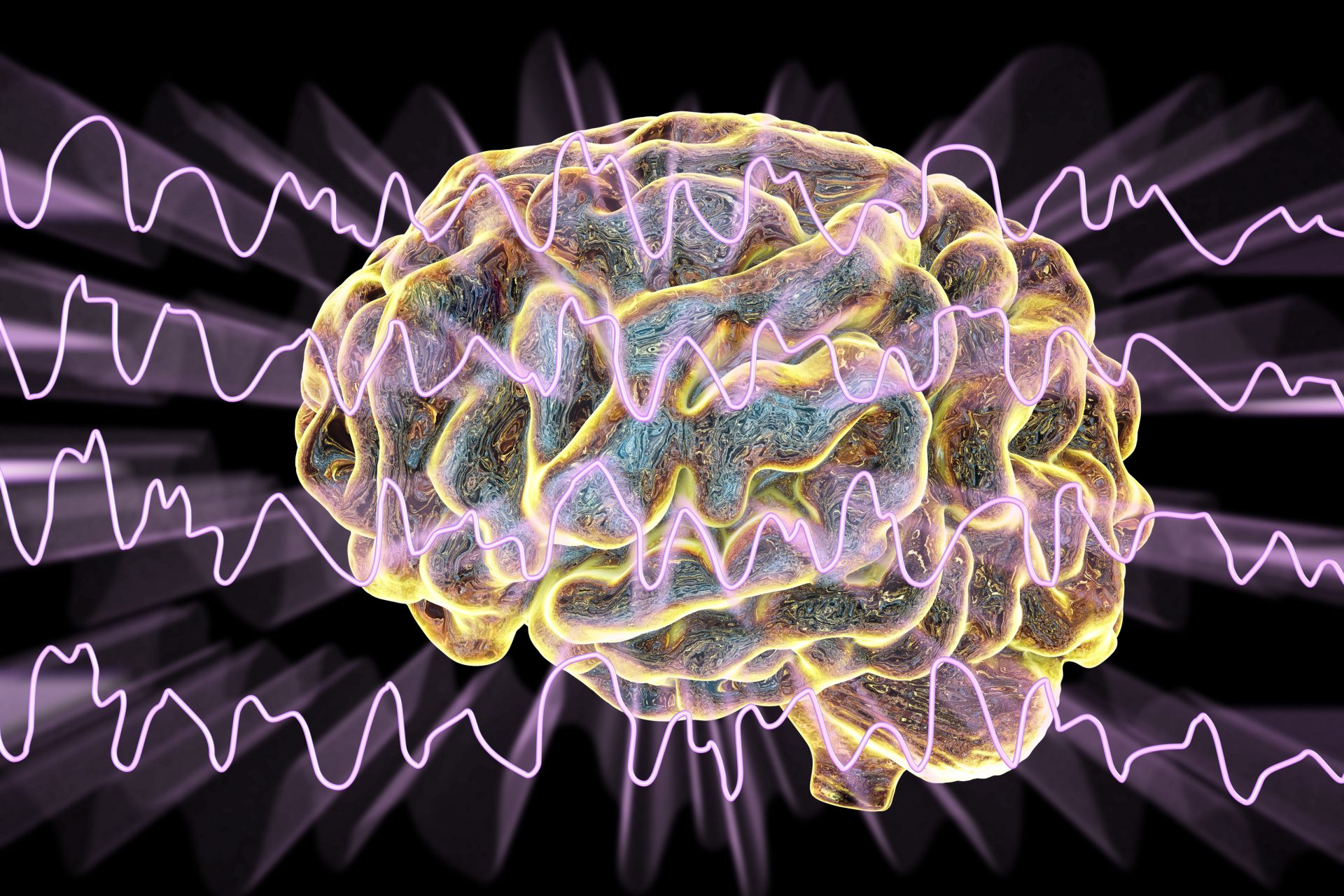 Redes cerebrais ficam fora de sintonia 