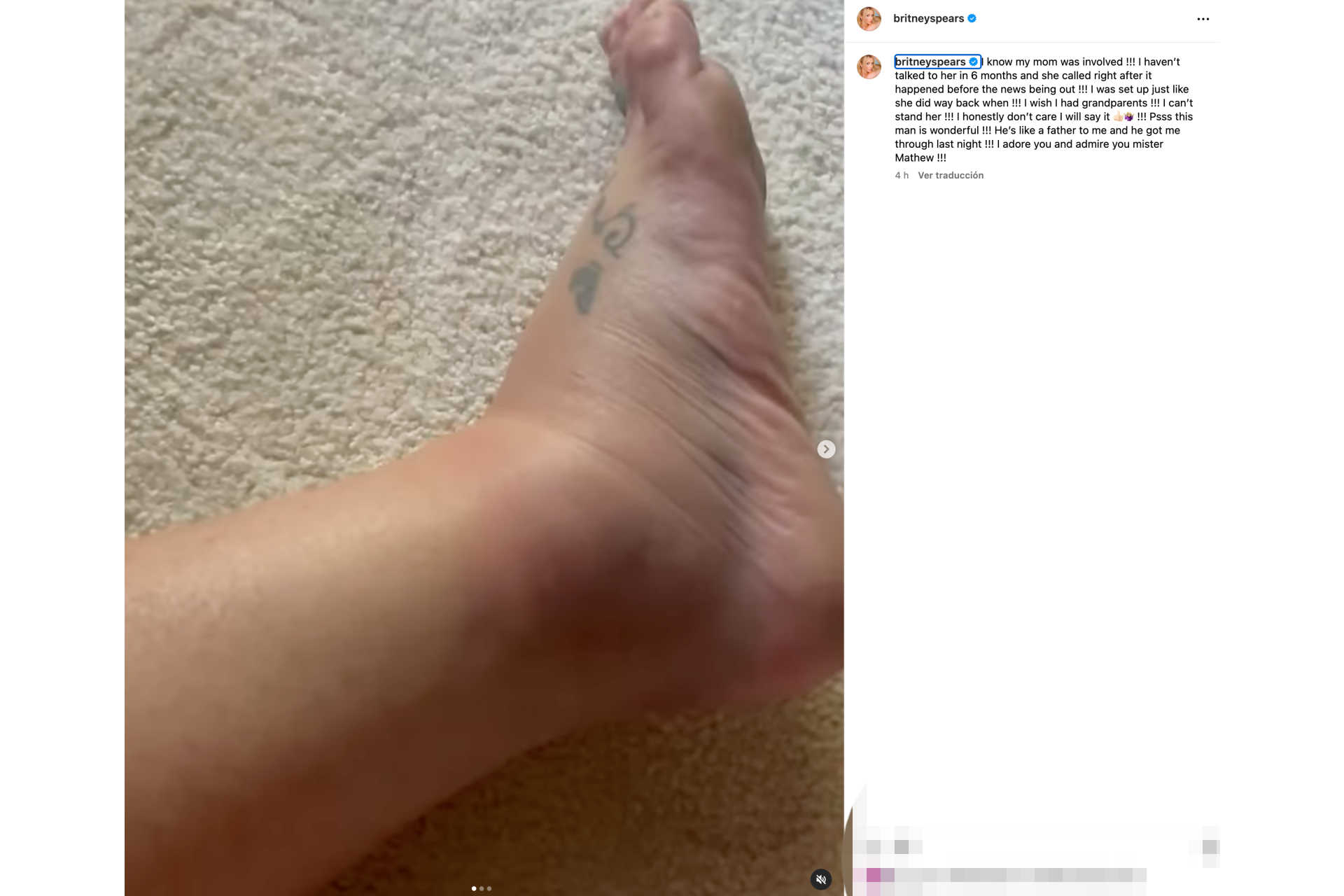 Britney's ankle