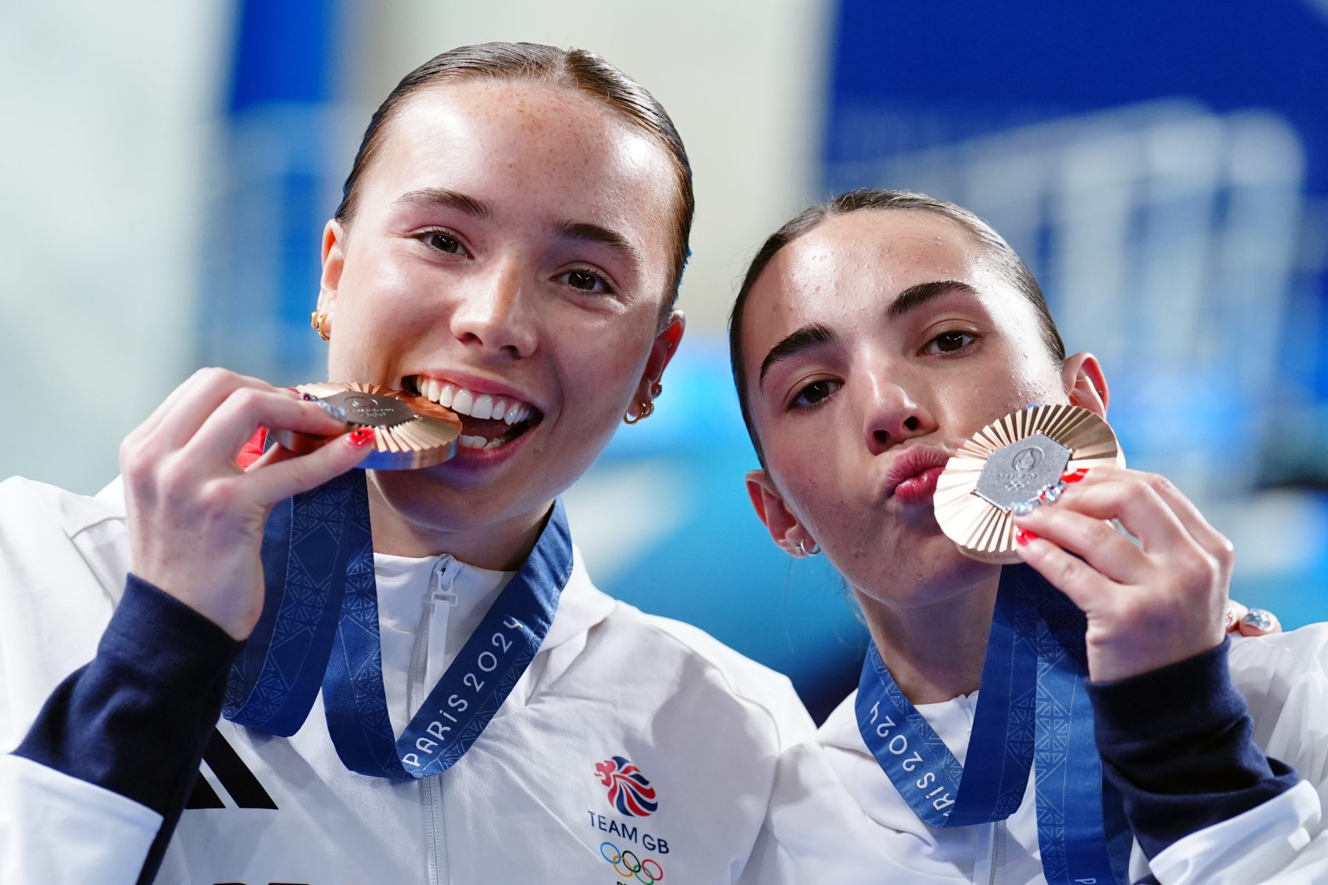 ¿Se proporcionarán recambios para las medallas dañadas?