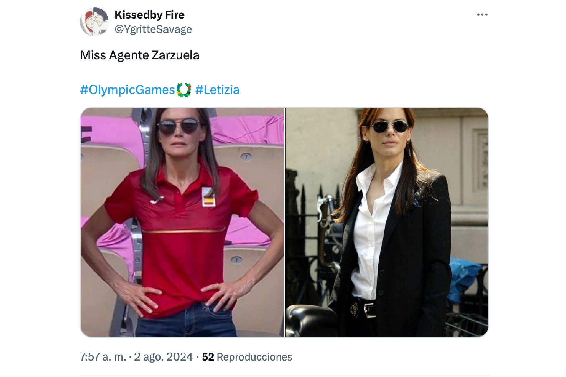 Miss Agente Zarzuela